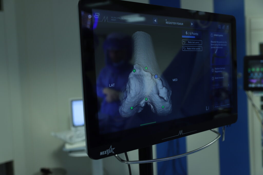 protesi ginocchio robot e protesi anca robot